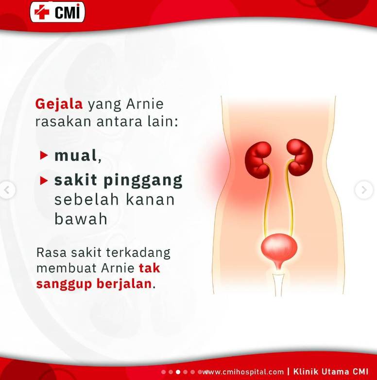 MAU SEMBUH GINJAL TANPA MENDERITA? PILIHLAH PENGOBATAN GAGAL GINJAL TANPA CUCI DARAH 